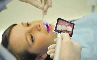 Caméra intra orale sans fil rend les dentistes plus pratiques